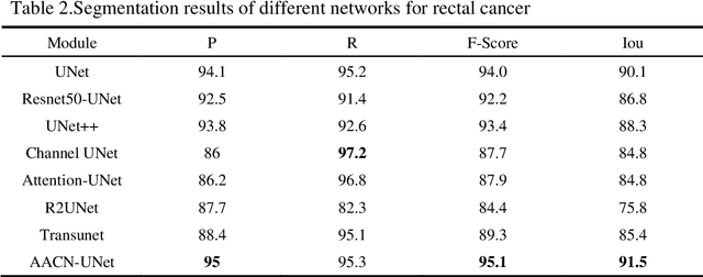 Figure 4 for Attention Augmented ConvNeXt UNet For Rectal Tumour Segmentation