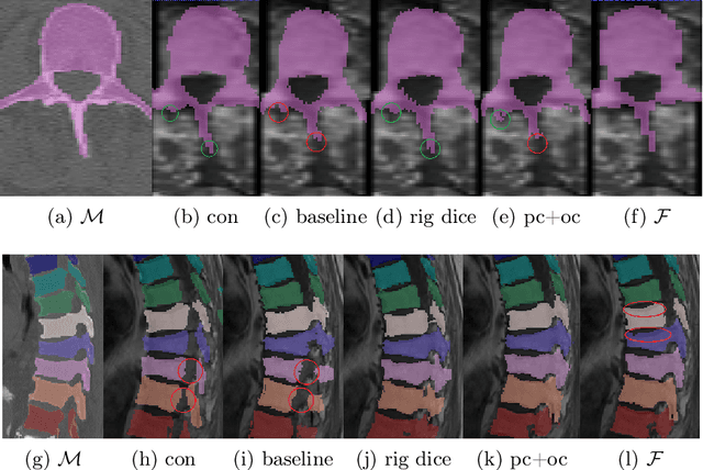 Figure 4 for Weakly-supervised Biomechanically-constrained CT/MRI Registration of the Spine