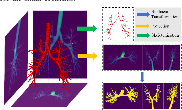 Figure 4 for Fuzzy Attention Neural Network to Tackle Discontinuity in Airway Segmentation