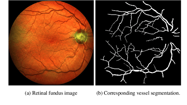 Figure 1 for Segmentation of blood vessels in retinal fundus images