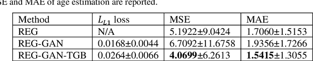 Figure 2 for Image Augmentation Using a Task Guided Generative Adversarial Network for Age Estimation on Brain MRI