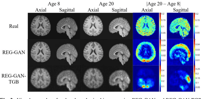 Figure 4 for Image Augmentation Using a Task Guided Generative Adversarial Network for Age Estimation on Brain MRI