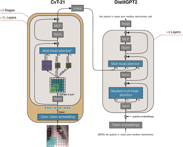 Figure 4 for Improving Chest X-Ray Report Generation by Leveraging Warm-Starting