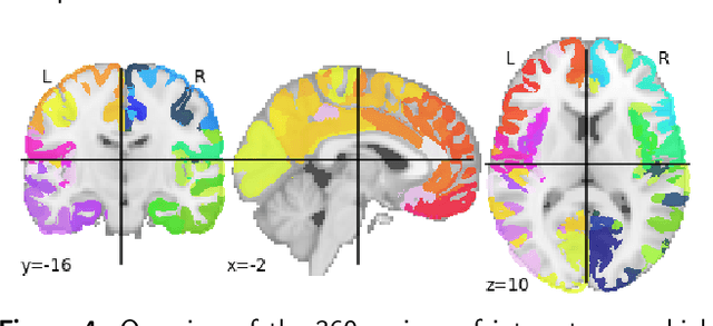 Figure 4 for Graph-LDA: Graph Structure Priors to Improve the Accuracy in Few-Shot Classification