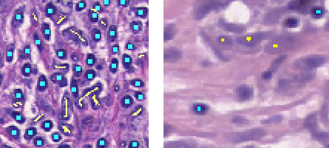 Figure 3 for Automatic Lymphocyte Detection in H&E Images with Deep Neural Networks