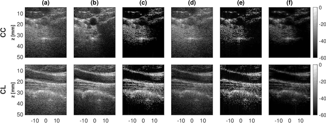 Figure 2 for A Unifying Approach to Ultrasound Beamforming and Deconvolution Using ADMM