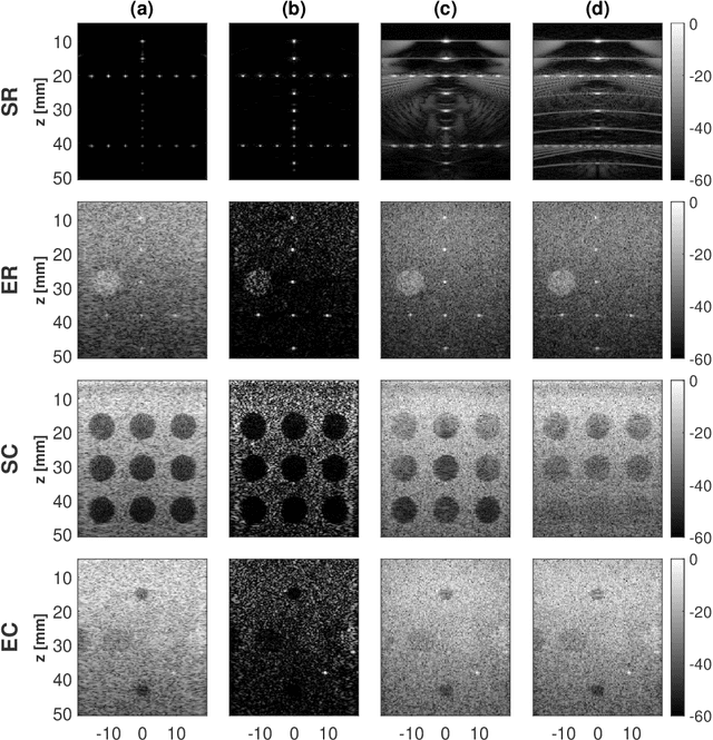 Figure 3 for A Unifying Approach to Ultrasound Beamforming and Deconvolution Using ADMM