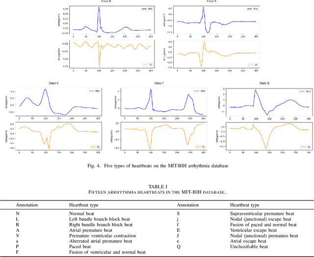 Figure 4 for Heart-Darts: Classification of Heartbeats Using Differentiable Architecture Search