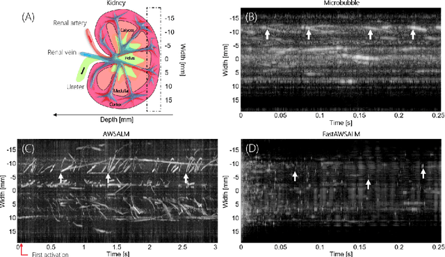 Figure 3 for Fast and selective super-resolution ultrasound in vivo with sono-switchable nanodroplets