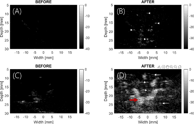 Figure 4 for Fast and selective super-resolution ultrasound in vivo with sono-switchable nanodroplets