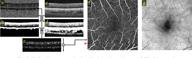Figure 3 for Efficient and high accuracy 3-D OCT angiography motion correction in pathology
