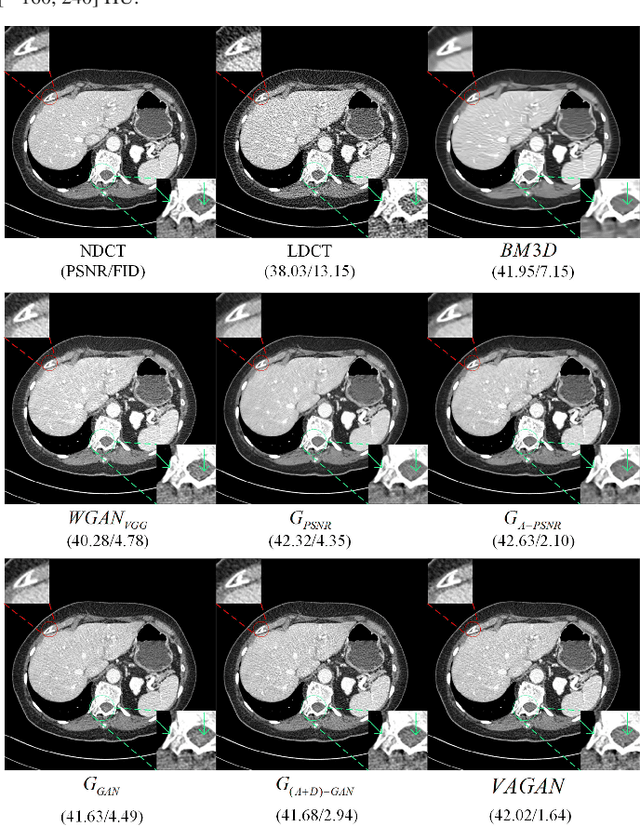 Figure 3 for Visual Attention Network for Low Dose CT