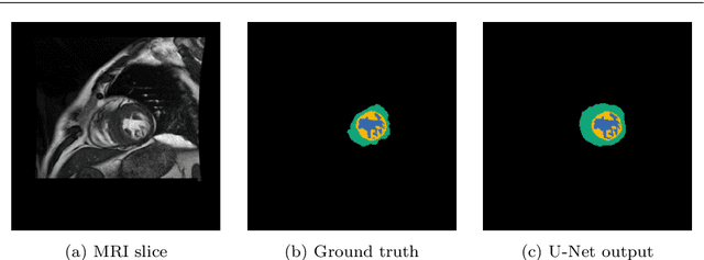 Figure 3 for Deep learning approach to left ventricular non-compaction measurement