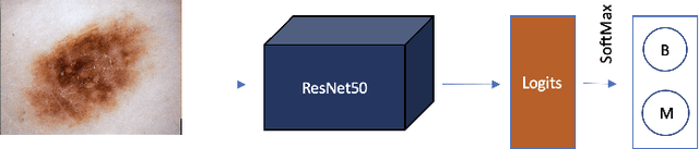 Figure 3 for Knowledge Distillation approach towards Melanoma Detection