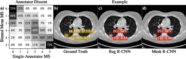 Figure 3 for Reg R-CNN: Lesion Detection and Grading under Noisy Labels