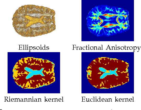 Figure 4 for Kernel Methods on Riemannian Manifolds with Gaussian RBF Kernels