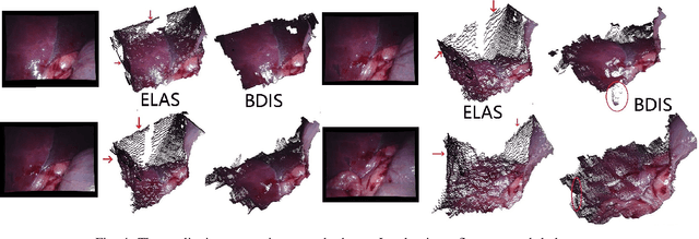 Figure 3 for Bayesian dense inverse searching algorithm for real-time stereo matching in minimally invasive surgery