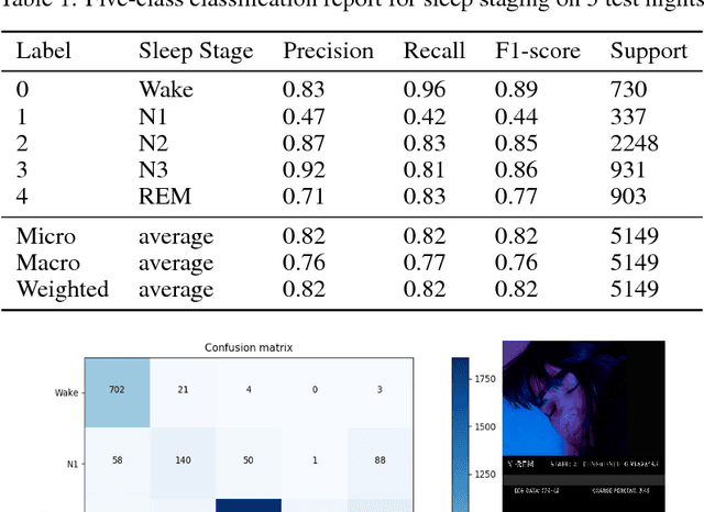 Figure 1 for Real-Time Sleep Staging using Deep Learning on a Smartphone for a Wearable EEG