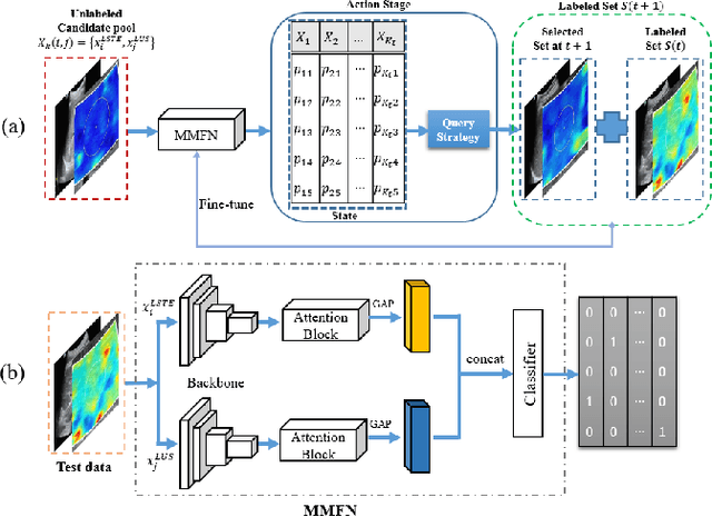 Figure 1 for Multi-Modal Active Learning for Automatic Liver Fibrosis Diagnosis based on Ultrasound Shear Wave Elastography