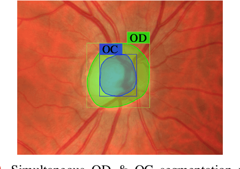 Figure 1 for Robust Segmentation of Optic Disc and Cup from Fundus Images Using Deep Neural Networks