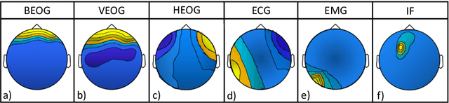 Figure 3 for Convolutional Neural Networks for Automatic Detection of Artifacts from Independent Components Represented in Scalp Topographies of EEG Signals