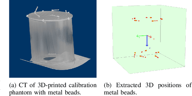 Figure 3 for Disassemblable Fieldwork CT Scanner Using a 3D-printed Calibration Phantom