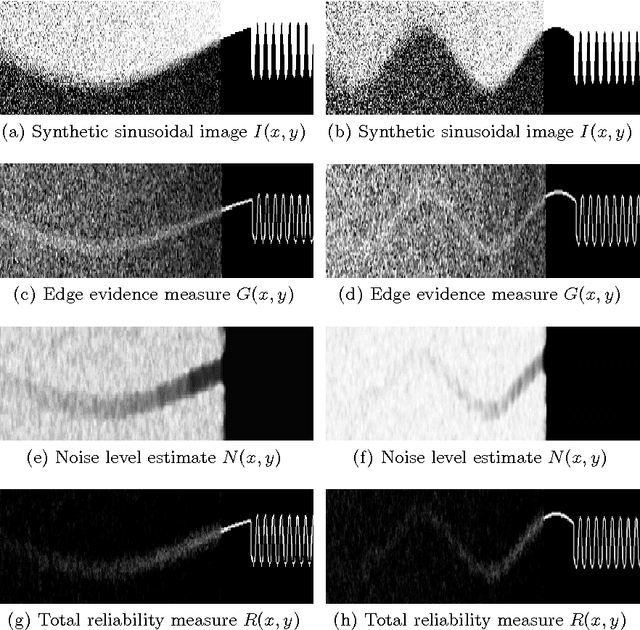 Figure 1 for Automatic Spatially-Adaptive Balancing of Energy Terms for Image Segmentation