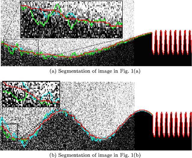 Figure 2 for Automatic Spatially-Adaptive Balancing of Energy Terms for Image Segmentation