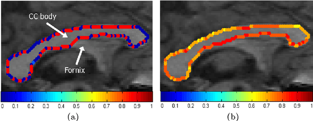 Figure 3 for Automatic Spatially-Adaptive Balancing of Energy Terms for Image Segmentation