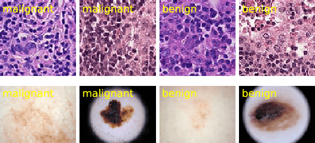 Figure 1 for Robust Medical Image Classification from Noisy Labeled Data with Global and Local Representation Guided Co-training