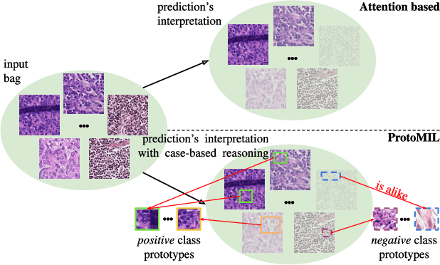 Figure 1 for ProtoMIL: Multiple Instance Learning with Prototypical Parts for Fine-Grained Interpretability