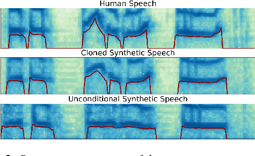 Figure 4 for Prosody Cloning in Zero-Shot Multispeaker Text-to-Speech