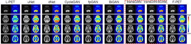 Figure 3 for A resource-efficient deep learning framework for low-dose brain PET image reconstruction and analysis