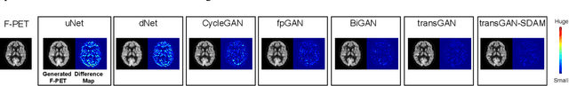 Figure 4 for A resource-efficient deep learning framework for low-dose brain PET image reconstruction and analysis