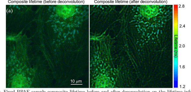 Figure 3 for Deconvolution in Fluorescence Lifetime imaging microscopy (FLIM)