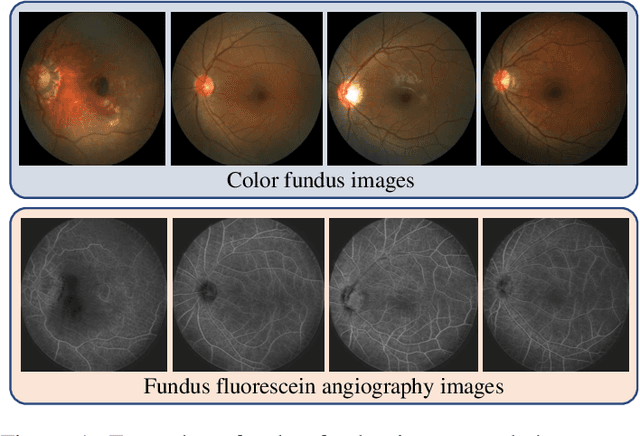 Figure 1 for Self-supervised Feature Learning via Exploiting Multi-modal Data for Retinal Disease Diagnosis