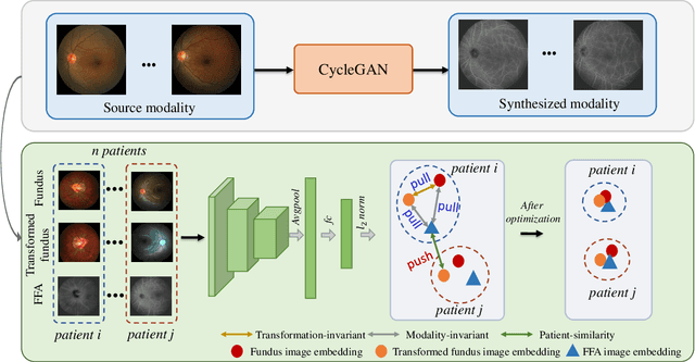 Figure 2 for Self-supervised Feature Learning via Exploiting Multi-modal Data for Retinal Disease Diagnosis
