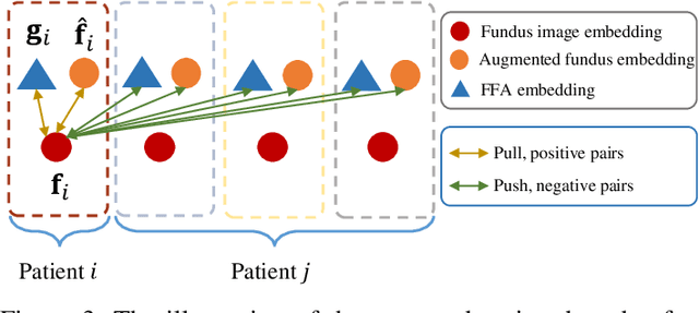 Figure 3 for Self-supervised Feature Learning via Exploiting Multi-modal Data for Retinal Disease Diagnosis