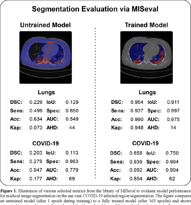 Figure 2 for MISeval: a Metric Library for Medical Image Segmentation Evaluation