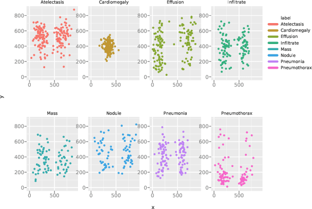 Figure 3 for CheXNet: Radiologist-Level Pneumonia Detection on Chest X-Rays with Deep Learning