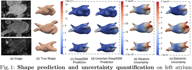 Figure 1 for Uncertain-DeepSSM: From Images to Probabilistic Shape Models