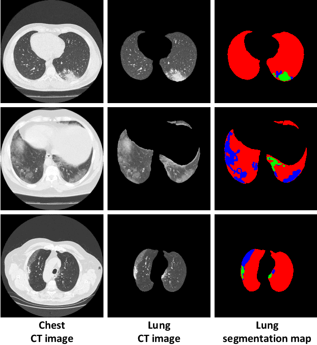 Figure 1 for COVID-19 CT Image Synthesis with a Conditional Generative Adversarial Network