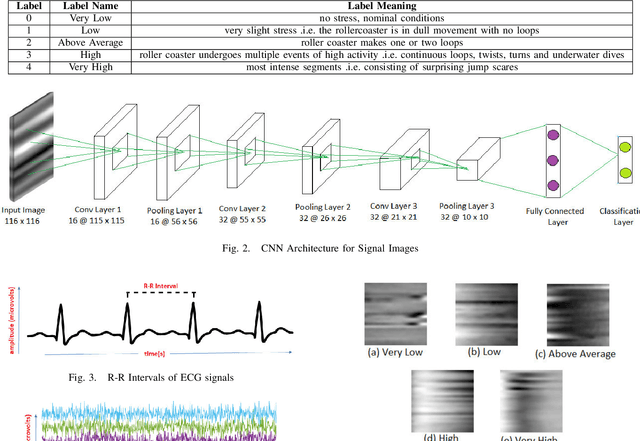 Figure 2 for Multi-level Stress Assessment Using Multi-domain Fusion of ECG Signal