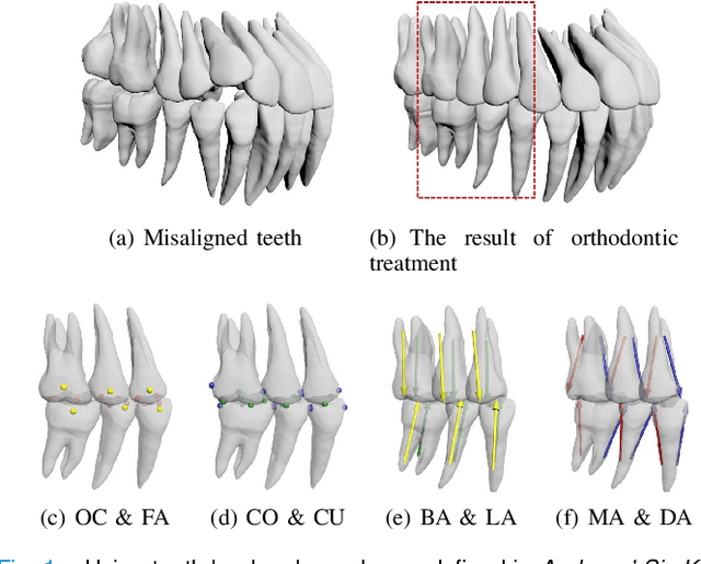 Figure 1 for Dense Representative Tooth Landmark/axis Detection Network on 3D Model