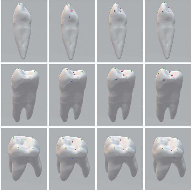 Figure 2 for Dense Representative Tooth Landmark/axis Detection Network on 3D Model