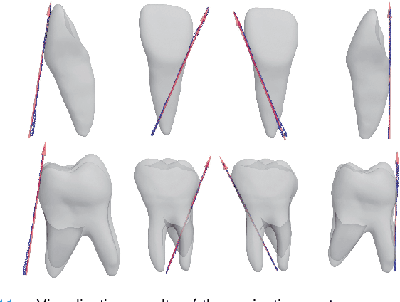 Figure 3 for Dense Representative Tooth Landmark/axis Detection Network on 3D Model
