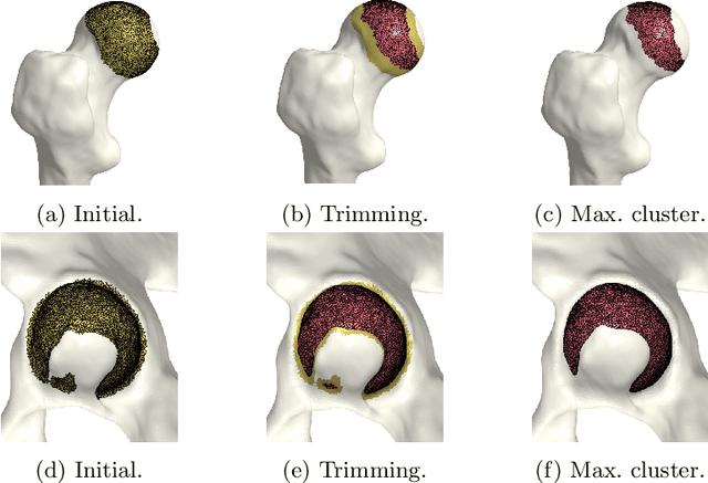 Figure 1 for A direct geometry processing cartilage generation method using segmented bone models from datasets with poor cartilage visibility