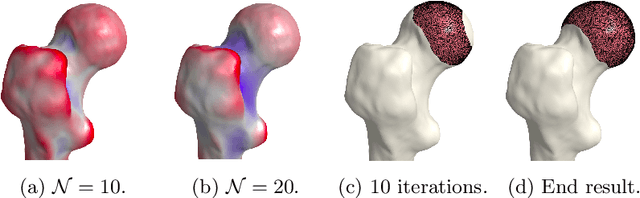 Figure 4 for A direct geometry processing cartilage generation method using segmented bone models from datasets with poor cartilage visibility
