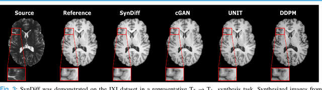 Figure 3 for Unsupervised Medical Image Translation with Adversarial Diffusion Models
