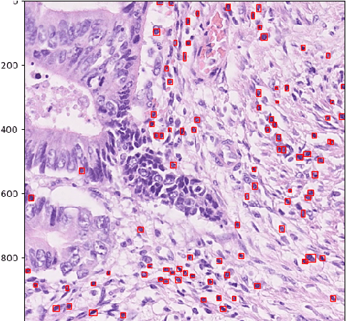 Figure 2 for Lymphocyte counting -- Error Analysis of Regression versus Bounding Box Detection Approaches